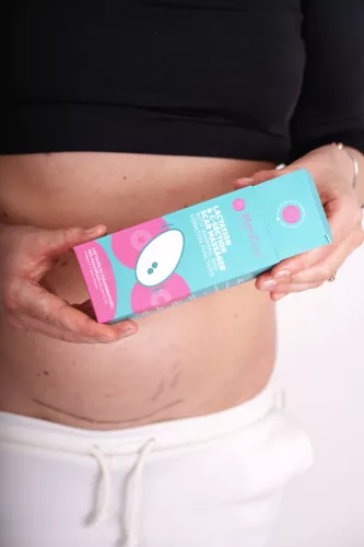 Momcare Laktációs és császármetszés utáni heg masszírozó