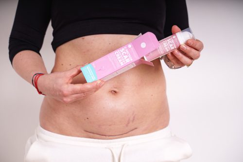 Momcare Császármetszés hegápoló krém 50ml