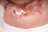 Momcare Császármetszés hegápoló krém 50ml
