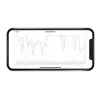 Milian légzésfigyelő PRO Bluetooth Plus 3db érzékelőlappal