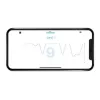 Milian légzésfigyelő PRO Bluetooth Plus 3db érzékelőlappal