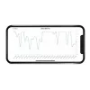 Milian légzésfigyelő Lite Bluetooth 2db érzékelőlappal